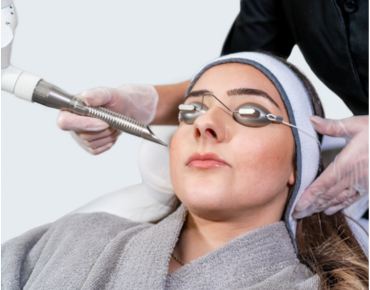 Mole Removal
