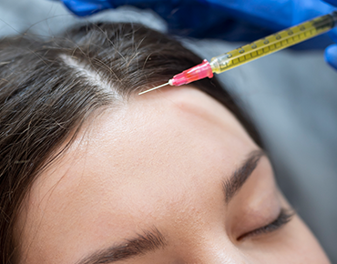PRP Treatment